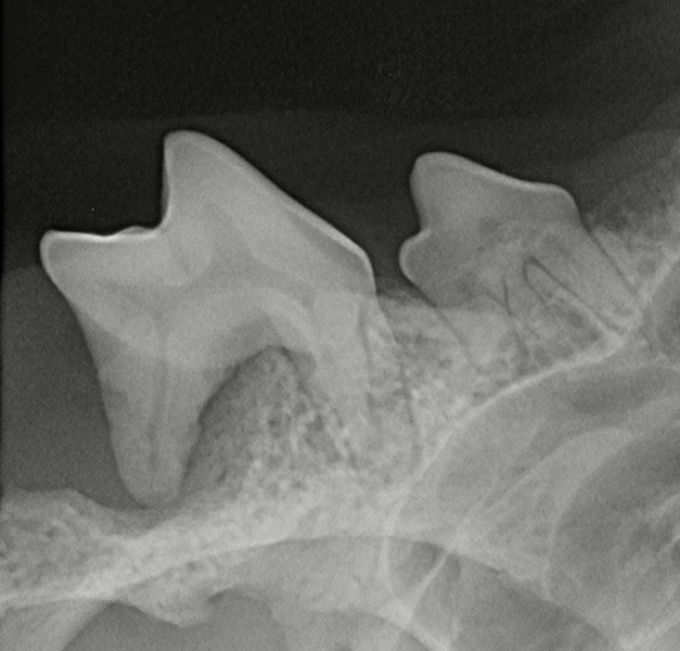 dentalroentgen
